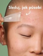 Hero Cosmetics Mighty Patch XL obliži za problematično kožo 10 kos