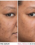 IT Cosmetics Bye Bye Dark Spots posvetlitveni korekcijski serum proti pigmentnim madežem z niacinamidom za ženske 30 ml