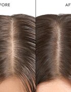 KERASILK Specialists Exfoliating Scalp & Hair Treatment nega pred šamponiranjem z učinkom eksfoliacije 200 ml