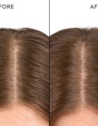 KERASILK Specialists Moisturizing Scalp Drops kapljice za suho in občutljivo lasišče 100 ml