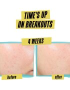 Kiehl's Dermatologist Solutions Expertly Clear Blemish-Treating & Preventing Lotion krema za obraz za aknasto kožo za ženske 60 ml