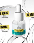 Kiehl's Dermatologist Solutions Truly Targeted Blemish-Clearing Solution serum za aknasto kožo za ženske 15 ml
