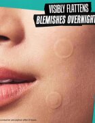 Kiehl's Truly Targeted Overnight Blemish Patch obliži za problematično kožo za ženske 22 kos
