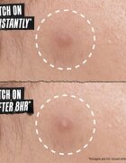 Kiehl's Truly Targeted Overnight Blemish Patch obliži za problematično kožo za ženske 22 kos