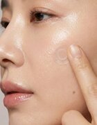 KORIKA Skin Essentials Microneedle Trouble spot patches obliži za problematično kožo proti aknam 9 kos