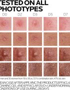 La Roche-Posay Effaclar set za problematično kožo akne