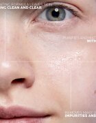 La Roche-Posay Effaclar Ultra čistilna micelarna voda za problematično kožo akne 200 ml