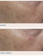 LANCER GRAVITY DARK SPOT CORRECTING SERUM serum proti temnim madežem 30 ml