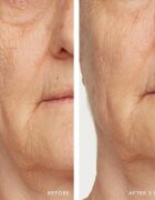 LANCER NOURISH REHYDRATION MASK vlažilna in hranilna maska za obraz 50 ml