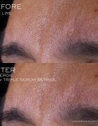 Lancôme Rénergie CRX Triple Serum Retinol serum za obraz 20 ml