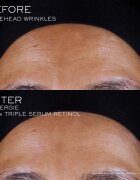 Lancôme Rénergie CRX Triple Serum Retinol serum za obraz 50 ml