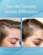 Living Proof Scalp Care serum za obnovitev gostote las 50 ml