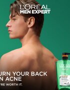 L’Oréal Paris Men Expert Derma Control gel za prhanje primerno tudi za občutljivo in problematično kožo 1000 ml
