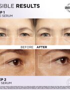 L’Oréal Paris Revitalift Filler set za nego obraza za obraz in predel okoli oči