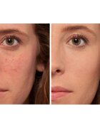 L’Oréal Paris True Match The One tekoči korektor odtenek 1.R/C Rose Ivory 6.8 ml