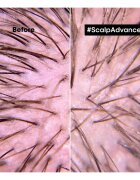 L’Oréal Professionnel Serie Expert Scalp Advanced lasna nega za lase in lasišče 200 ml