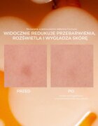 Lumene Nordic-C [VALO] Dark Spot Serum posvetlitveni serum z vitaminom C proti pigmentnim madežem 30 ml