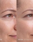 Mádara MÁDARA Kojic Alternative Pigment Serum serum proti pigmentnim madežem 30 ml