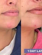 Mario Badescu Repairing Facial Spray With Hypochlorous Acid obnovitveno pršilo za obraz za pomiritev kože 118 ml