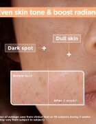 MIXA Anti-Dark Spot serum proti pigmentnim madežem 30 ml