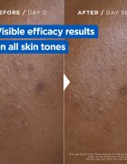 MIXA Niacinamide Bright intenzivno vlažilna krema proti temnim madežem 400 ml