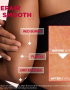 MIXA Urea Cica Repair+ regeneracijska krema za telo za zelo suho kožo 150 ml