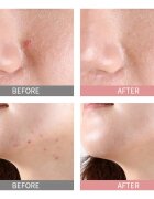 Mizon Good Bye Blemish Pink Spot lokalni serum s pudrom proti aknam 19 ml