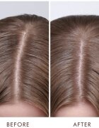 Moroccanoil Scalp Dry Scalp Treatment globinsko hranilna kura za suho kožo 45 ml