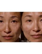Omorovicza Elixir eliksir za prehrano in revitalizacijo kože 30 ml