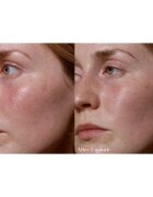 Omorovicza Elixir eliksir za prehrano in revitalizacijo kože 30 ml