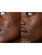 Omorovicza Elixir eliksir za prehrano in revitalizacijo kože 30 ml