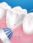 Oral-B Aquacare 4 ustna prha 1 kos