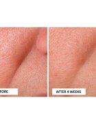 Perricone MD Cold Plasma Plus+ Advanced Serum hranljivi serum za obraz 30 ml