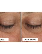 Perricone MD Cold Plasma Plus+ Eye Cream hranilna krema za predel okoli oči proti oteklinam in temnim kolobarjem 15 ml