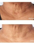 Perricone MD Cold Plasma Plus+ Sub-D/Neck učvrstitvena krema za vrat in dekolte 59 ml