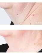 Perricone MD Cold Plasma Plus+ Sub-D/Neck učvrstitvena krema za vrat in dekolte 59 ml