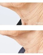 Perricone MD Cold Plasma Plus+ Sub-D/Neck učvrstitvena krema za vrat in dekolte 59 ml