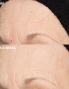 Perricone MD Cold Plasma Plus+ The Intensive Hydrating Complex intenzivna vlažilna krema 30 ml