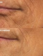 Perricone MD Cold Plasma Plus+ The Intensive Hydrating Complex intenzivna vlažilna krema 30 ml