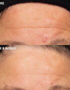 Perricone MD Cold Plasma Plus+ The Intensive Hydrating Complex intenzivna vlažilna krema 30 ml