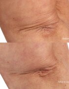 Perricone MD Essential Fx Acyl-Glutathione Chia Body Oil suho olje za telo 118 ml