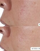 Perricone MD High Potency Face Finishing & Firming Toner tonik za učvrstitev kože 118 ml