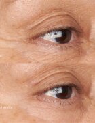 Perricone MD Hypoallergenic Clean Correction Eye Cream vlažilna in posvetlitvena nega za veke in kolobarje pod očmi 15 ml