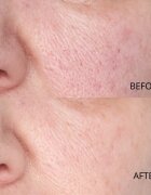 Perricone MD Hypoallergenic Clean Correction Smoothing Restorative Serum gladilni serum za hidracijo in posvetlitev kože 59 ml