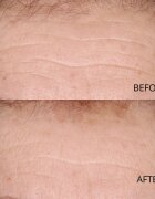 Perricone MD Hypoallergenic Clean Correction Smoothing Restorative Serum gladilni serum za hidracijo in posvetlitev kože 59 ml