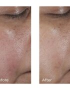 Perricone MD No:Rinse Pore Minimizing Toner intenzivni tonik za glajenje kože in zmanjšanje por 118 ml