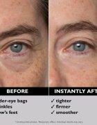 Peter Thomas Roth FIRMx® Eye Duo Set darilni set proti gubam okoli oči