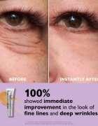 Peter Thomas Roth Instant FIRMx Eye krema za predel okoli oči za pomladitev kože 20 ml