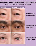 Peter Thomas Roth Instant FIRMx Eye krema za predel okoli oči za pomladitev kože 20 ml