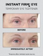 Peter Thomas Roth Instant FIRMx Eye krema za predel okoli oči za pomladitev kože 30 ml